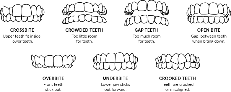 Invisalign Smile Assessment, Delisle Dental Group